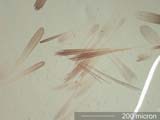 Moth Scales