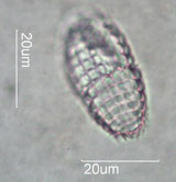 Coleps, Ciliate