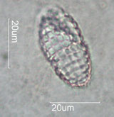 Coleps, Ciliate