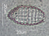 Coleps, Ciliate