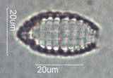Coleps, Ciliate