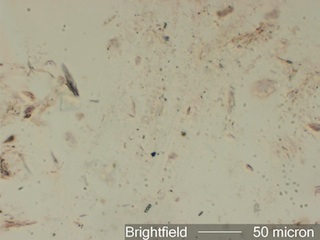 Chrysotile Field 1 in 1.550 RI Liquid Viewed with Brightfield Illumination