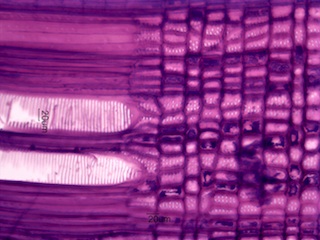 Cornus florida, Radial-Section