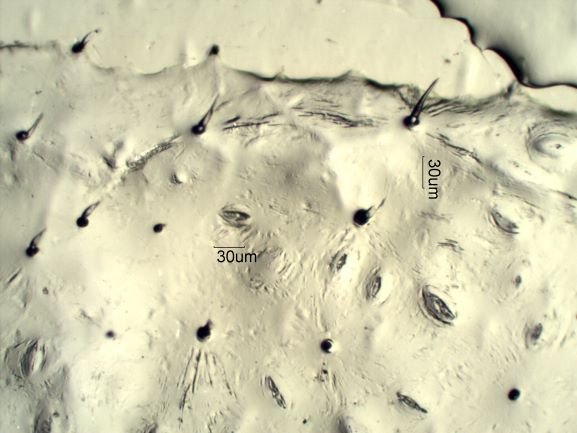 Stomata Under The Microscope
