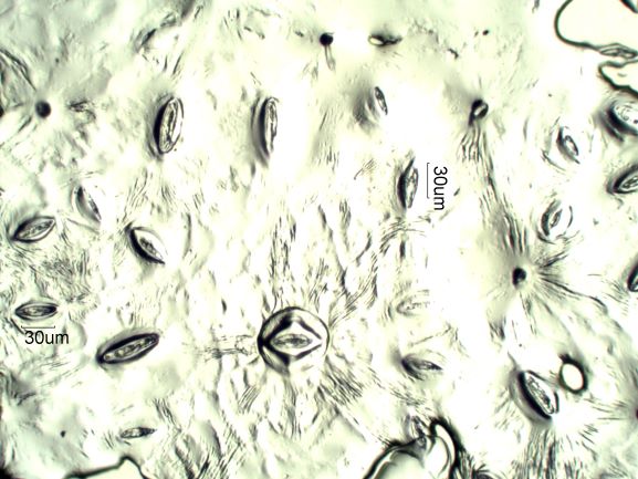 Stomata Under The Microscope