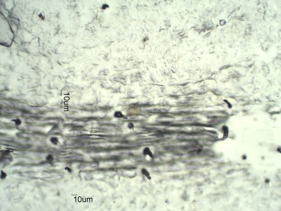 Stomata Under The Microscope