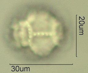 Narrowleaf Hawksbeard Pollen