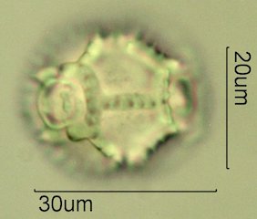 Narrowleaf Hawksbeard Pollen