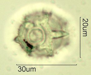 Narrowleaf Hawksbeard Pollen