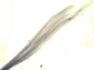 Crocidolite