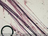 Crocidolite