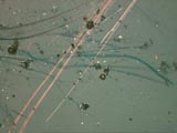 Crocidolite