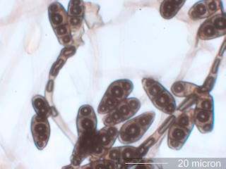 Curvularia Spores