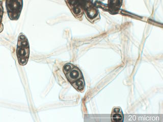 Curvularia Spores
