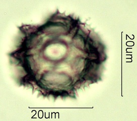 Dandelion Pollen