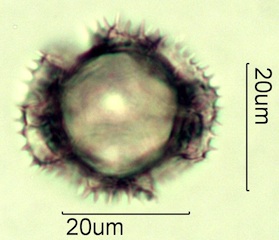 Dandelion Pollen