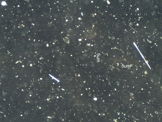 10X 0.25 NA Darkfield Image of Cleared Filter Containing Amosite