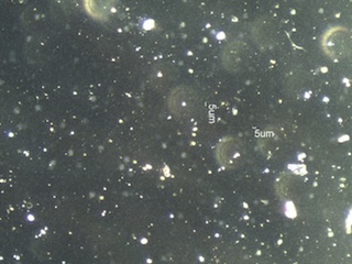 10X 0.25 NA Darkfield Image of Cleared Filter Containing Chrysotile
