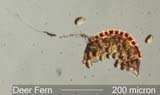 Deer Fern Sporangium Under the Microscope