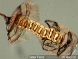 Deer Fern Sporangium
