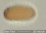 Deer Fern Spore Colpus Under the Microscope