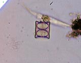 Diatom