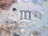 Diatom