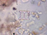 Diatom