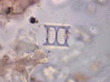 Diatom