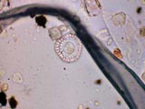 Diatom