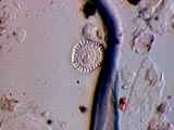 Diatom