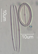 Diatom