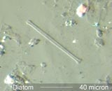 800X (zoom) Diatom 125-3