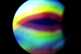 Darkfield Diffraction Pattern at Back Focal Plane