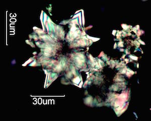 Dock Leaf CaOx