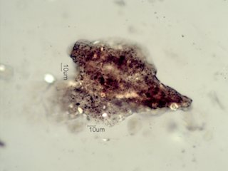 Dog Fecal Material