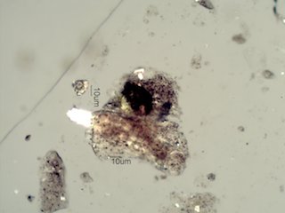 Dog Fecal Material