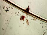 Dog Hair with Digested Debris Attached