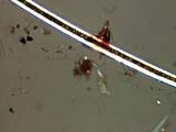 Dog Hair with Digested Debris Attached