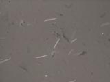 Stress Birefringence in Skin Flakes
