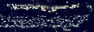 Calcium Oxalate Phytoliths