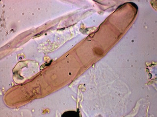 Drechslera Spores