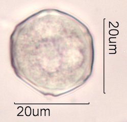 Elm (Ulmus sp.) Pollen