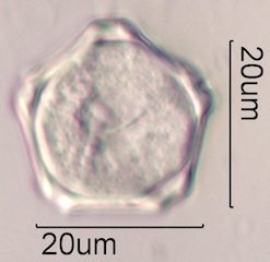 Elm (Ulmus sp.) Pollen