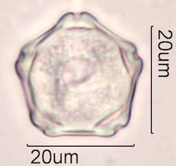 Elm (Ulmus sp.) Pollen