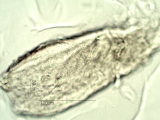 Demodex folliculorum