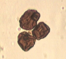 Epicoccum Spores