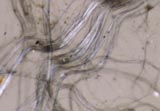 Erionite Off Crossed