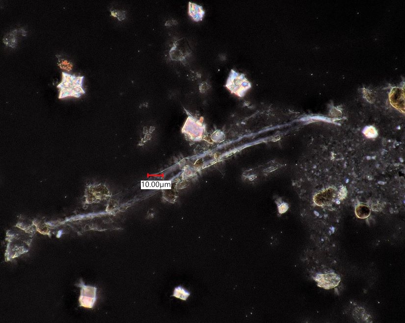 Eucalyptus Bark Phytoliths