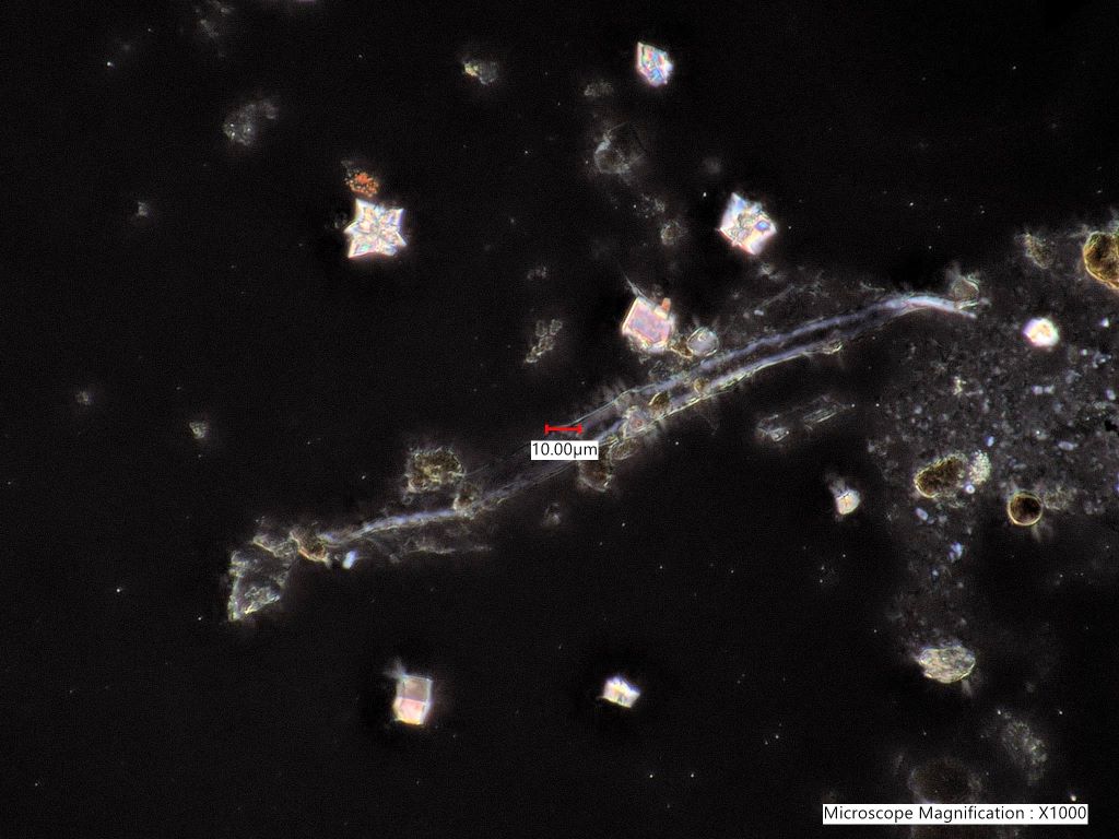 Eucalyptus Bark Phytoliths